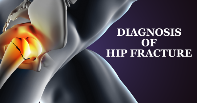 Diagnosis of hip fracture – Welcome to SYS Medtech International Pvt. Ltd.