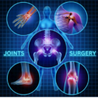 JOINTS SURGERY